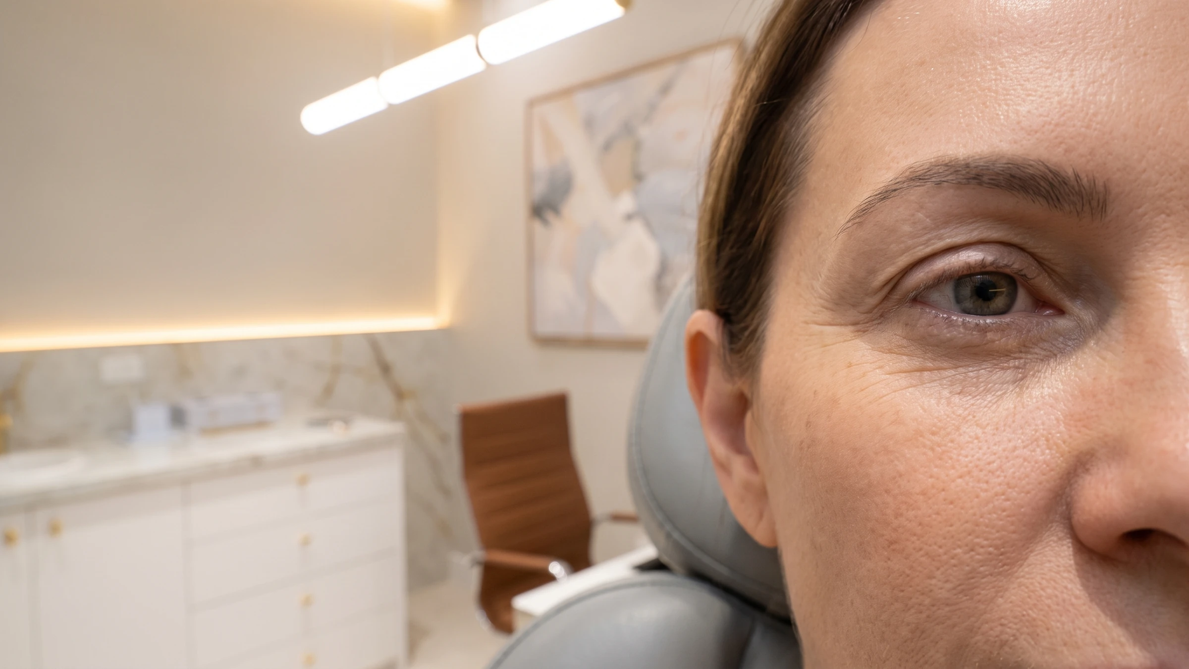 Crow's Feet Botox: What It Treats, What It Cannot Fix, and How to Keep Results Natural