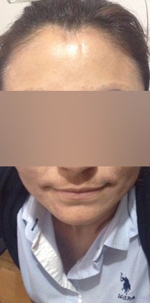 After