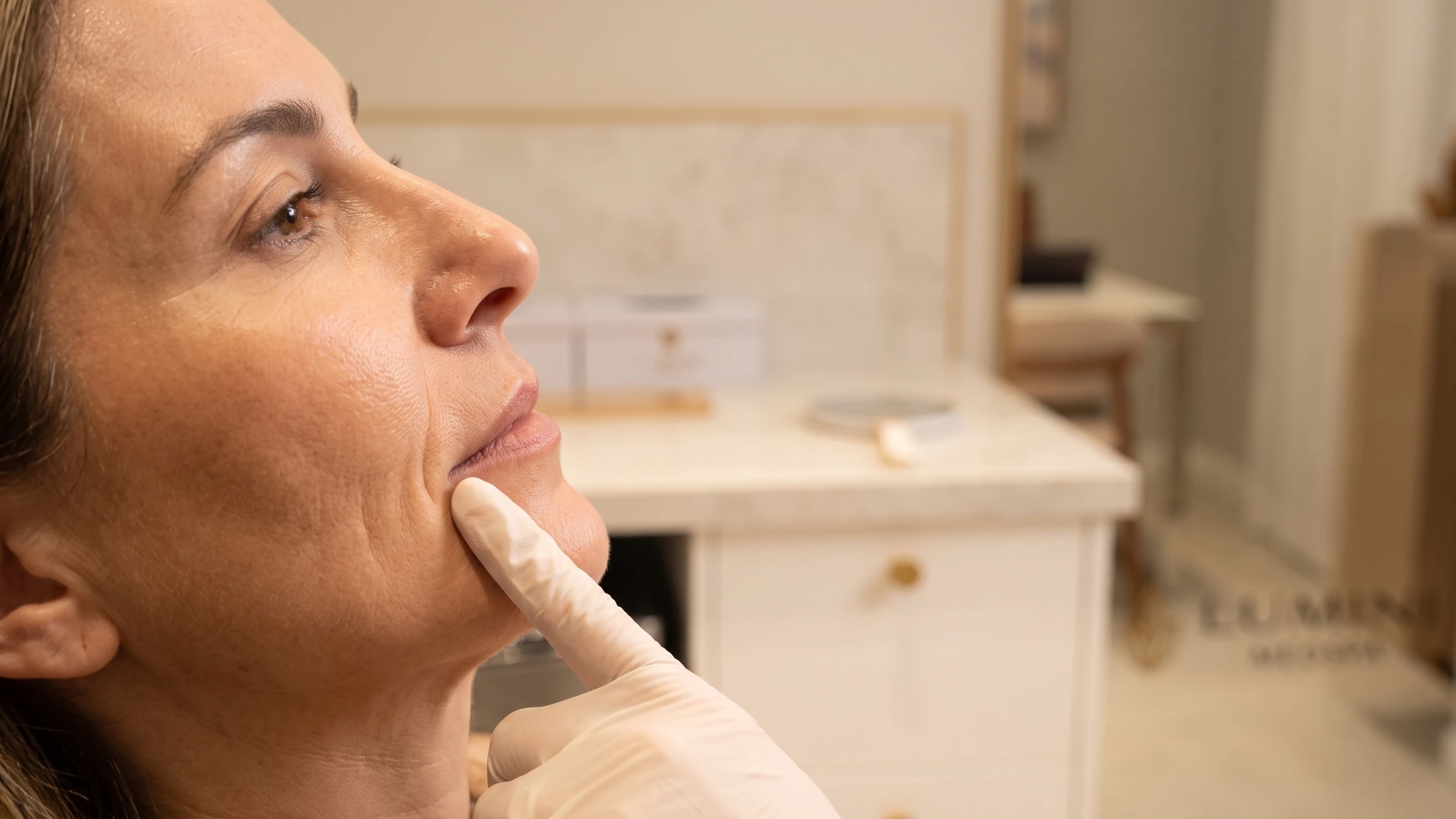 Marionette Lines: Filler, Biostimulators, or Structural Support?
