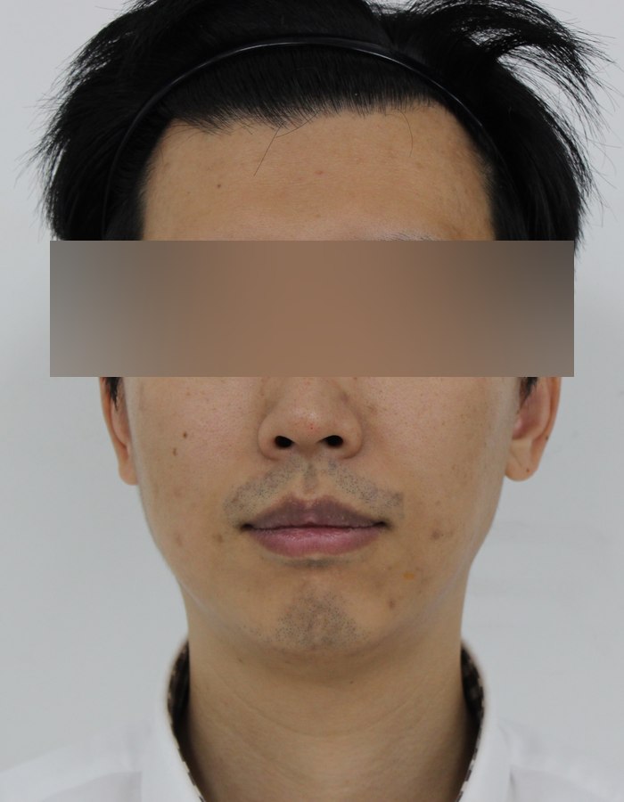 Before