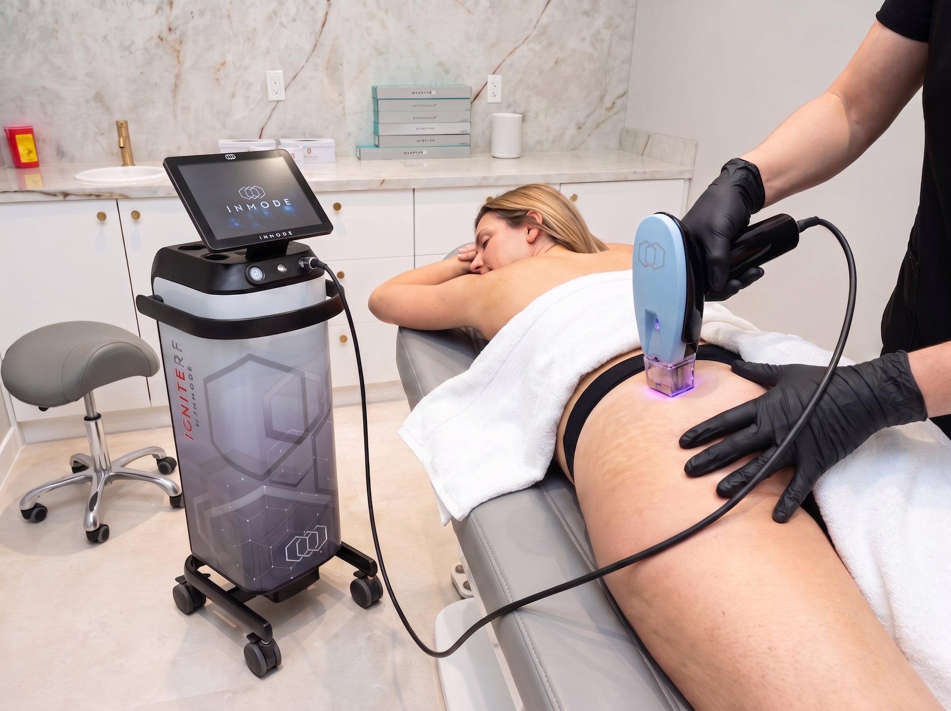 Cellulite reduction at Lumini Medical Spa in Aventura, FL
