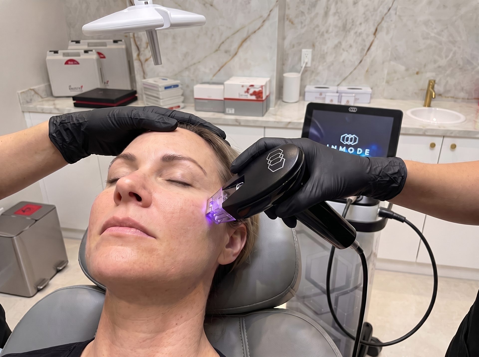 Morpheus8 for Golden Beach patients at Lumini Medical Spa in Aventura, FL