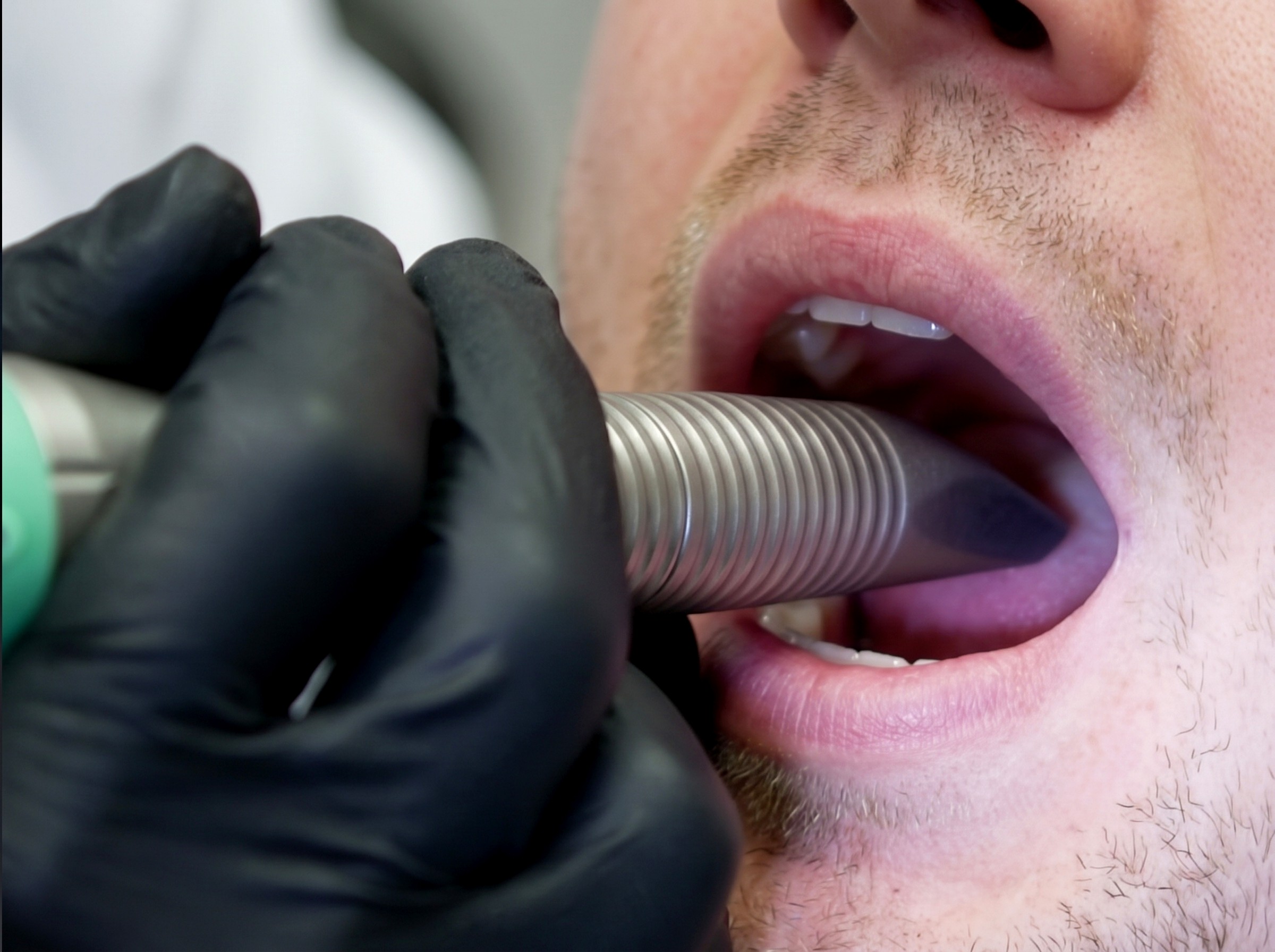 NightLase Snoring Treatment at Lumini Medical Spa in Aventura, FL