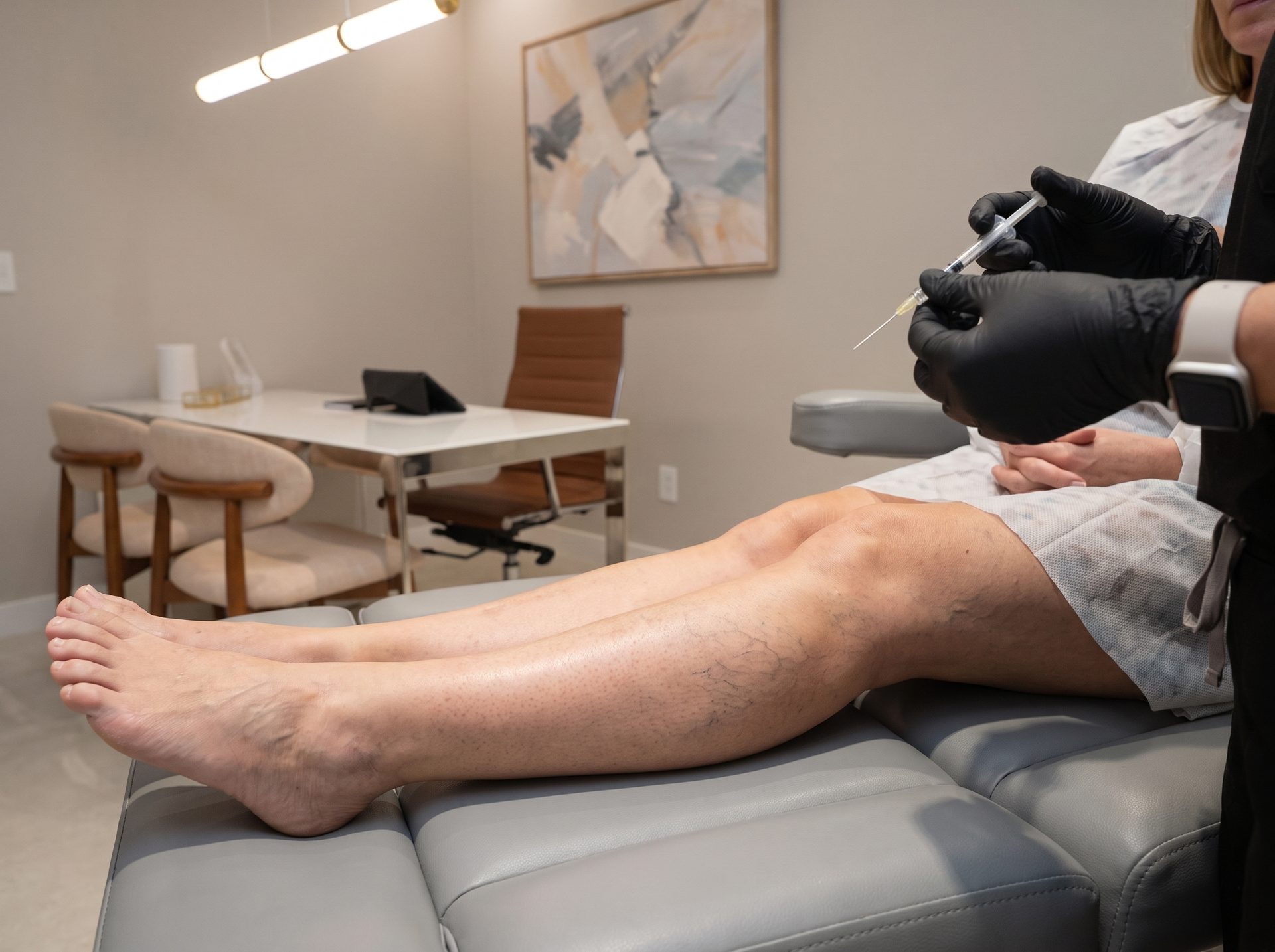 Spider vein treatments at Lumini Medical Spa in Aventura, FL